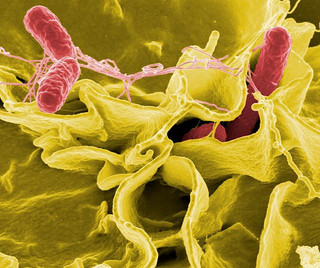 Salmonella bacteria, by NAID